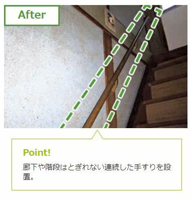 階段の上り下りが怖い。after